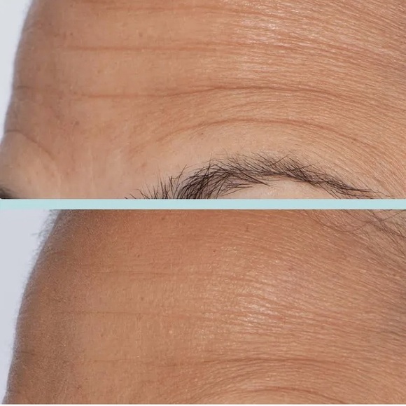 BOUNCE-BOOSTING SERUM WITH COLLAGEN First Aid Beauty - Picture 12 of 13